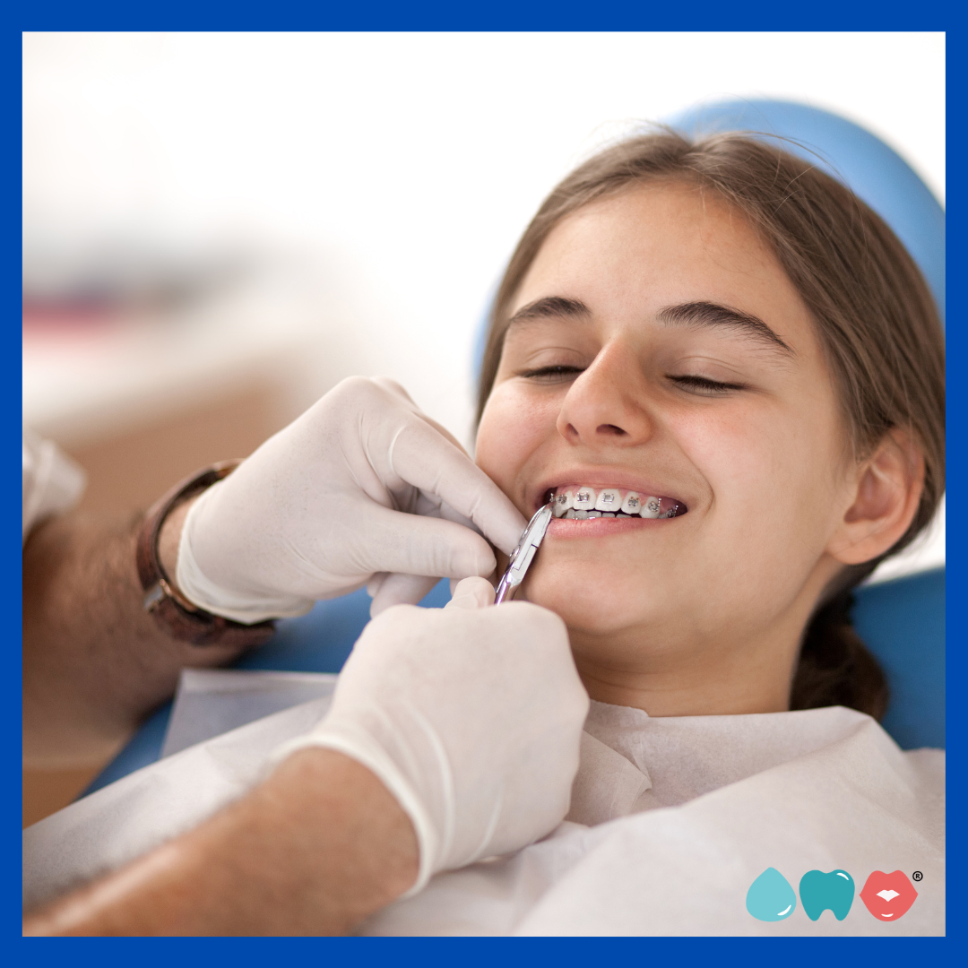braces on child fitting braces onto young patient orthodontics being applied to teeth
