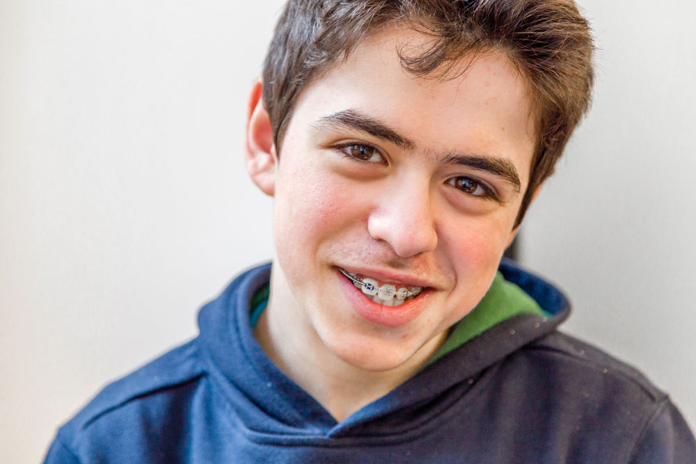 young man with braces on his teeth.