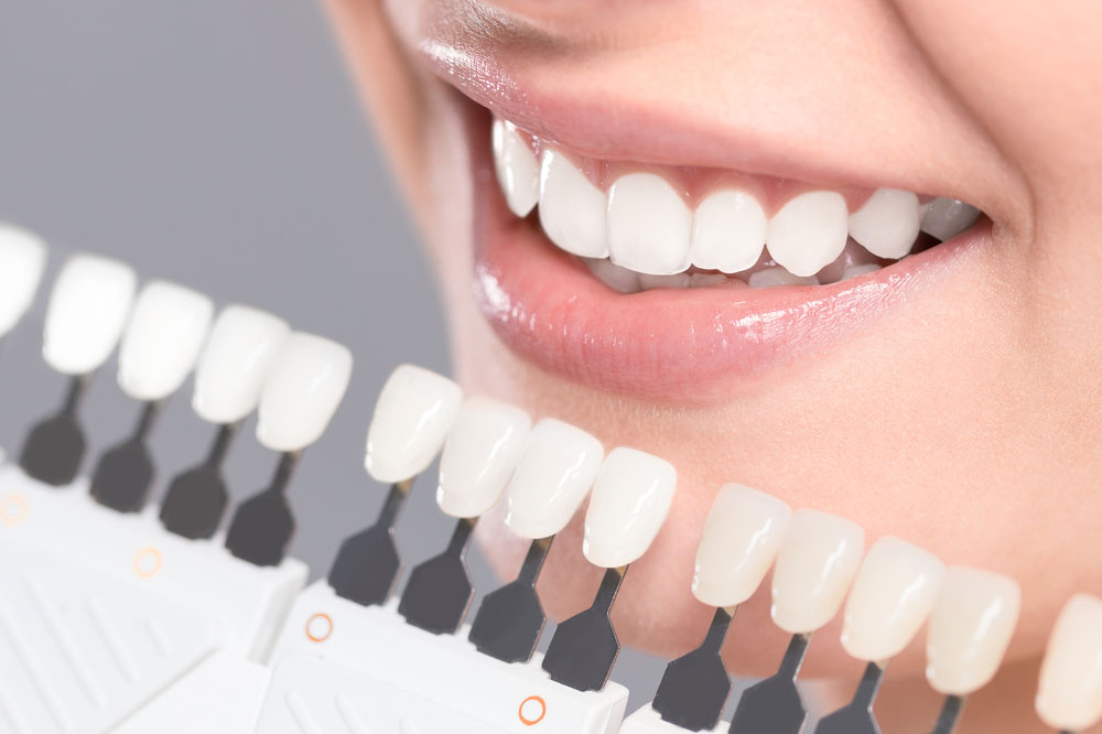 Top Teeth Whitening Methods - ToothShower