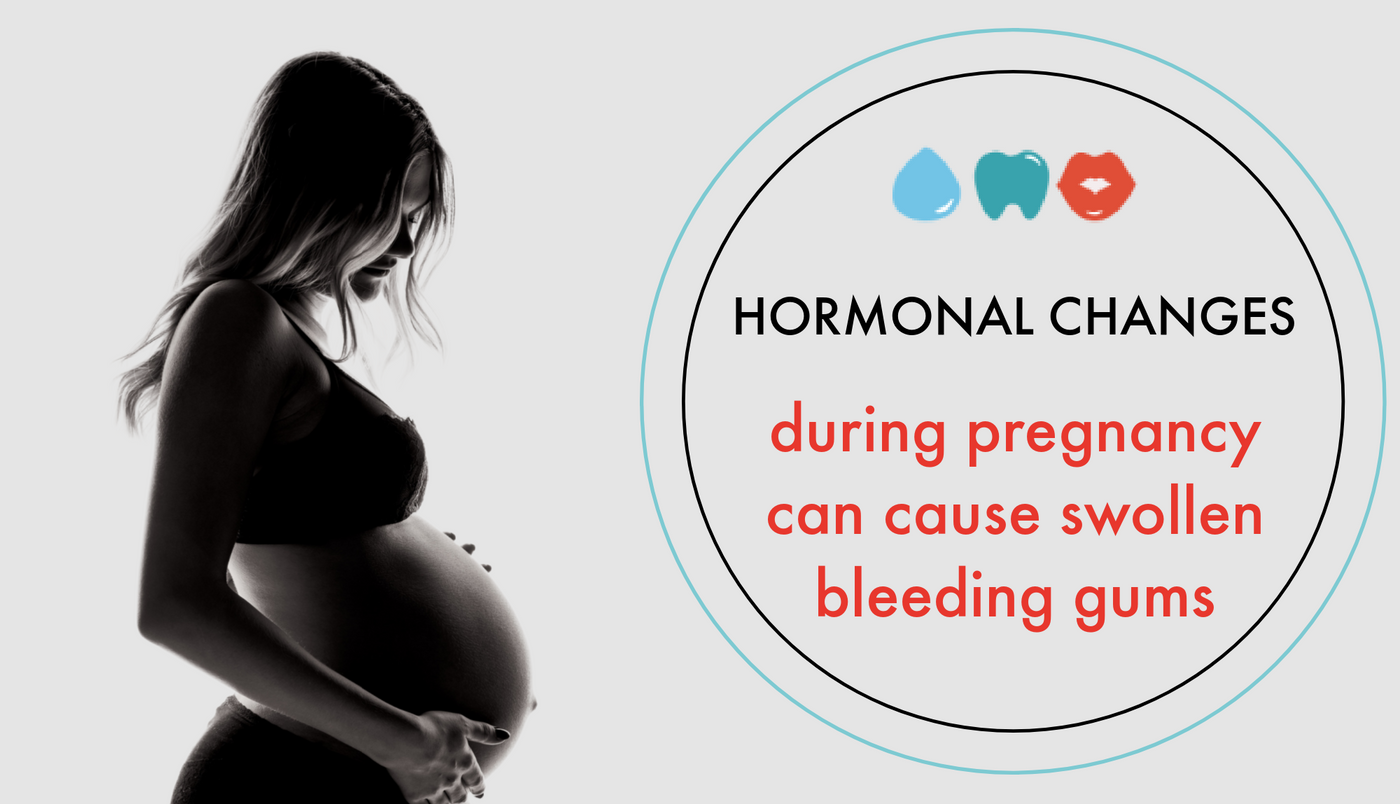 Pregnancy Gingivitis What You Need to Know ToothShower